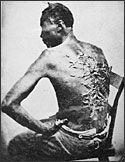 Slave with scars from whipping